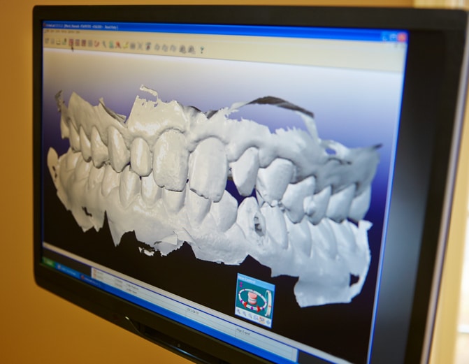 3D Technology In Dentistry