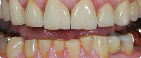 Cosmetic Dentistry – Bringing Out The Best In Smile!