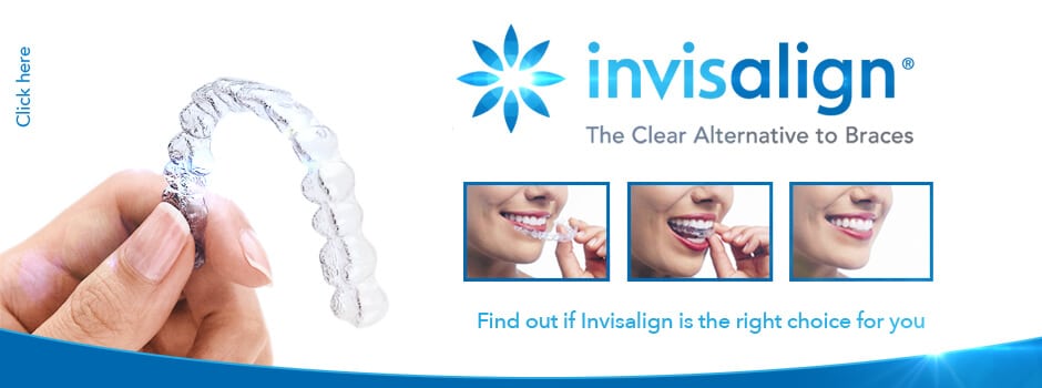 Invisalign-banner2